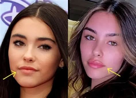 does madison beer have a boob job|Madison Beer plastic surgery: Breast Implants,Before。